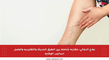 علاج الدوالي: مقارنة شاملة بين الطرق الحديثة والتقليدية وأفضل أساليب الوقاية